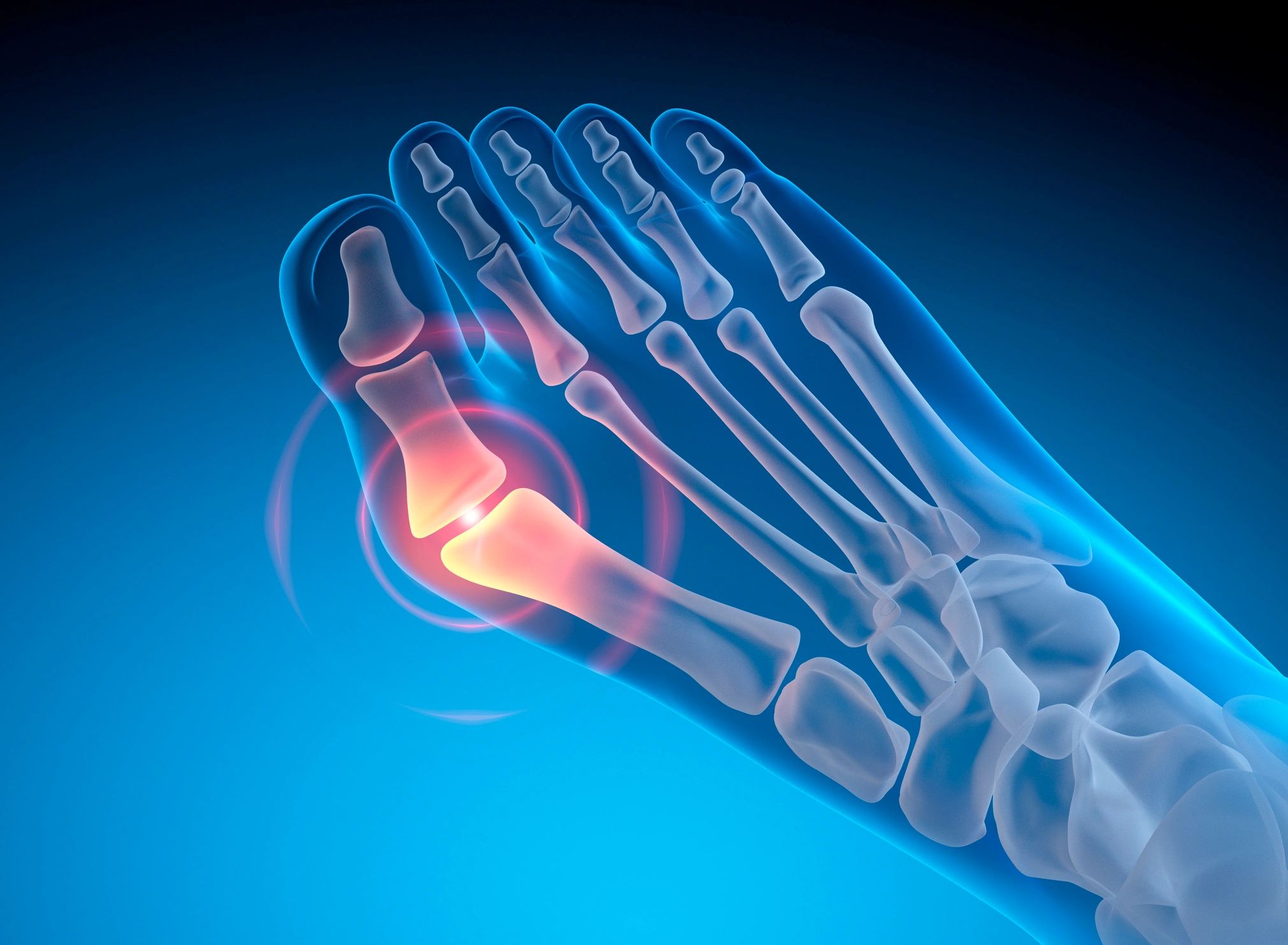 Foot and ankle X-ray illustration